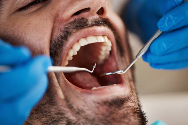 Best Emergency Root Canal Treatment in Calais, ME